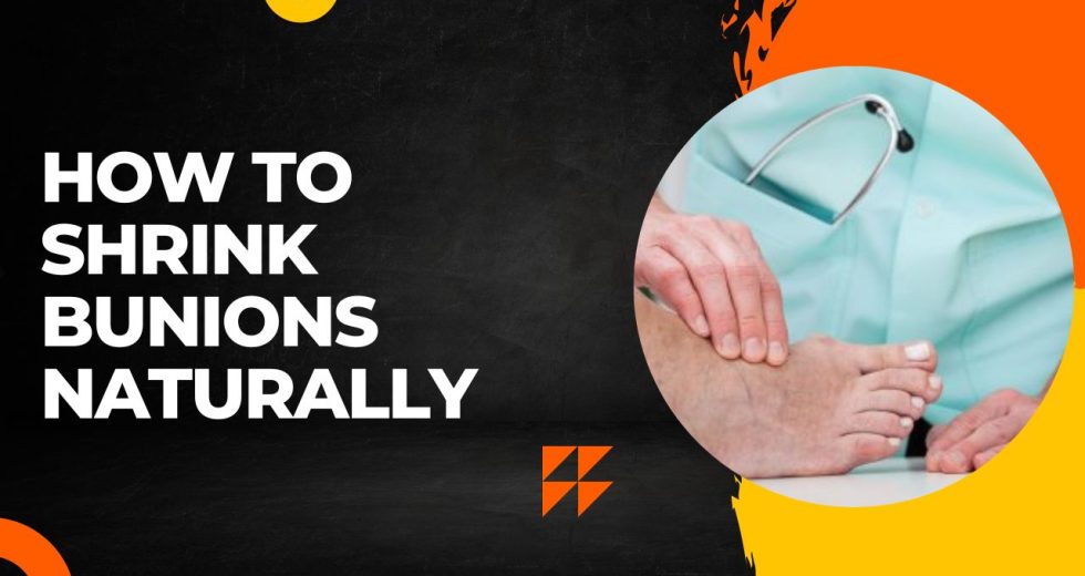 Step-by-Step: How to Shrink Bunions Naturally